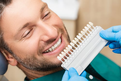 Man smiling as his teeth color is matched with a shade guide